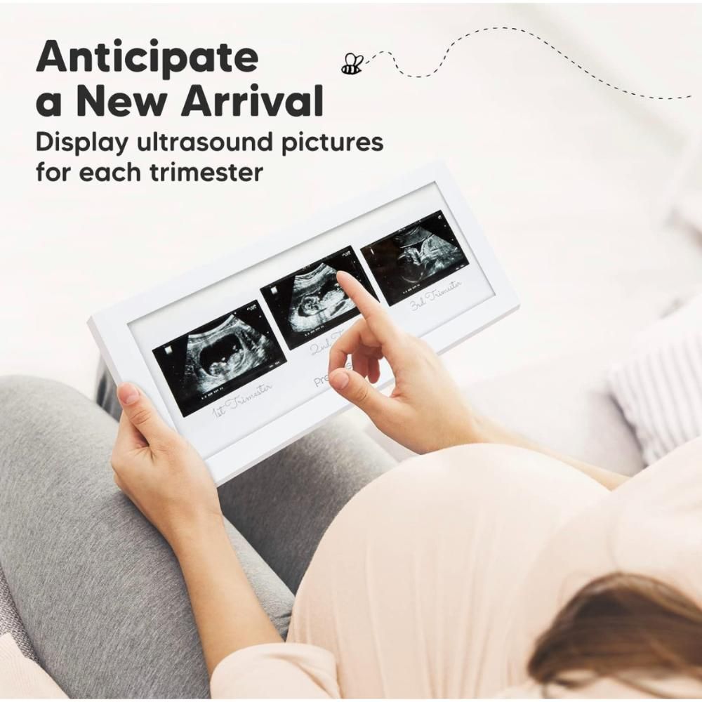 كبابيز - إطار صورة سونار ثلاثي - أبيض ثلجي