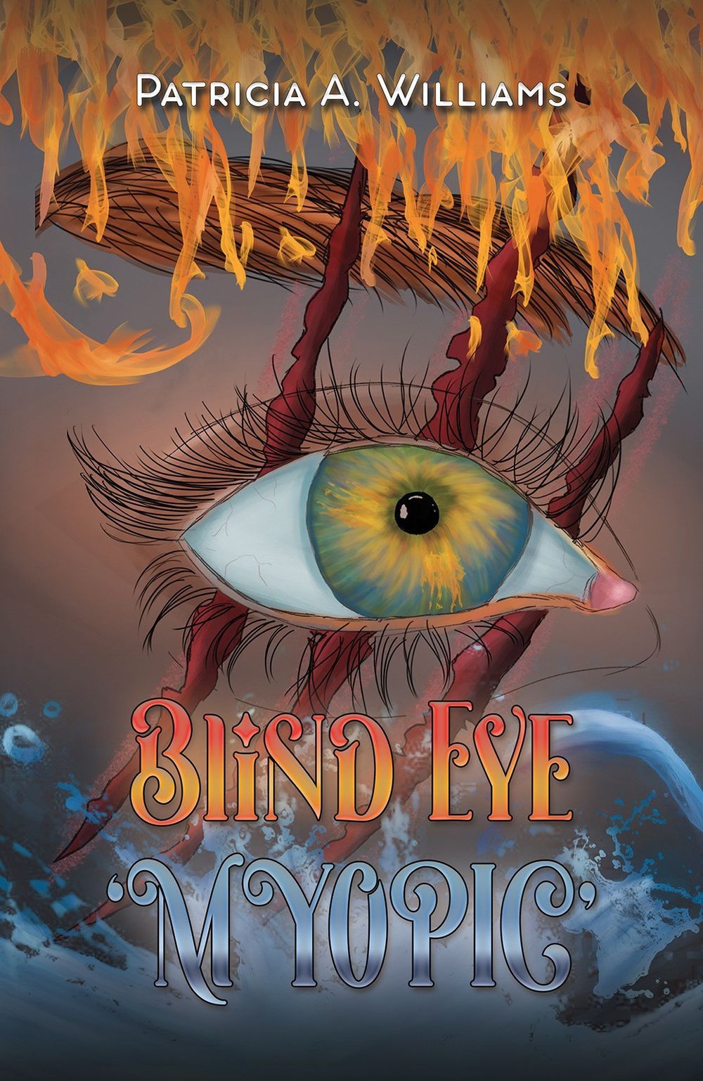 Blind Eye M Yopic