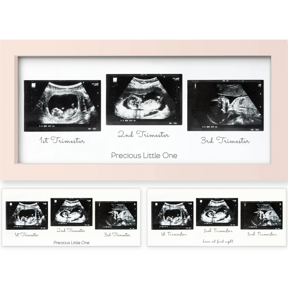 Keababies - Trio Baby Sonogram Frame - Petal Pink
