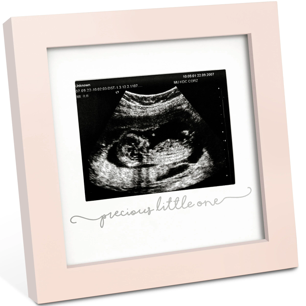 Keababies - Solo Baby Sonogram Frame - Petal Pink