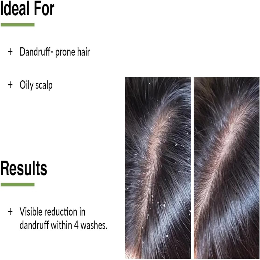 Fixderma - Kairfoll Anti-Dandruff Shampoo - 100 ml