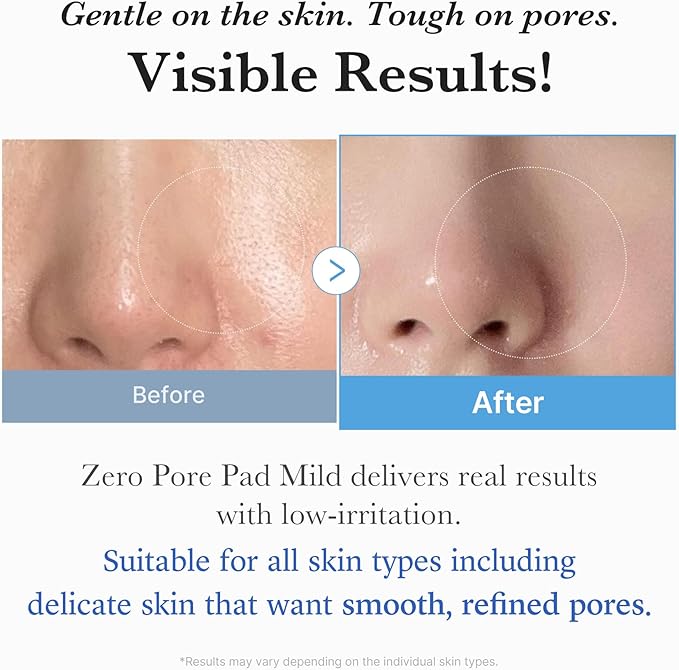 Medicube - Zero Pore Mild Pads - 70 Pads