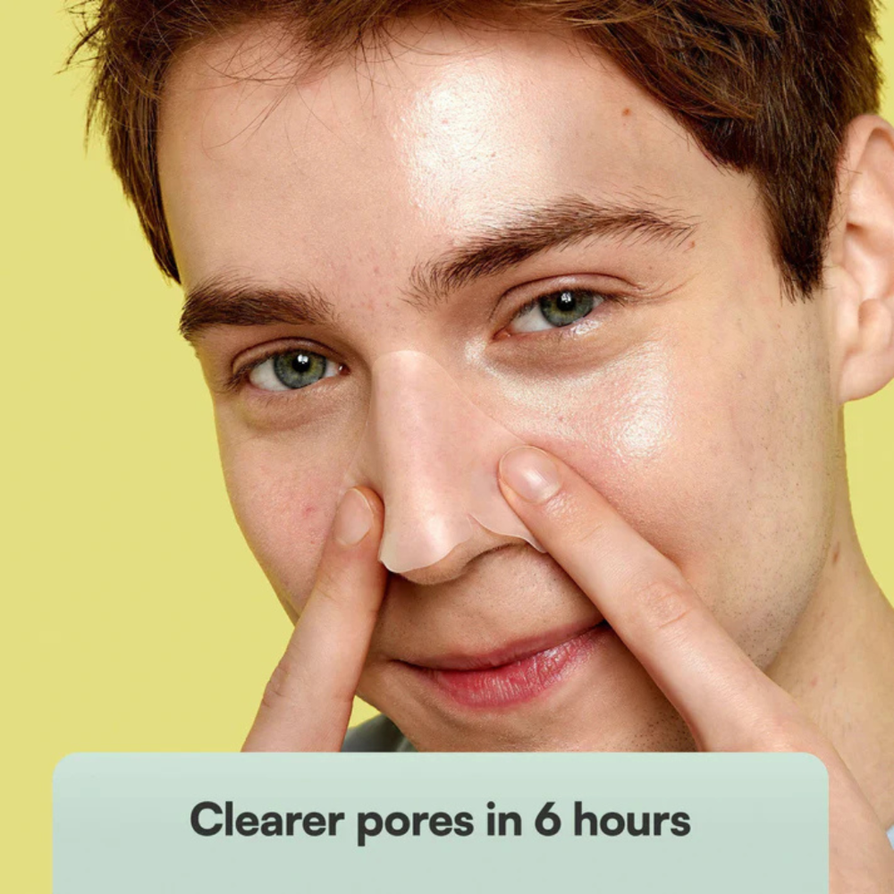 Skin Choice - Breakout Patch Classic Nose - 5 Patches