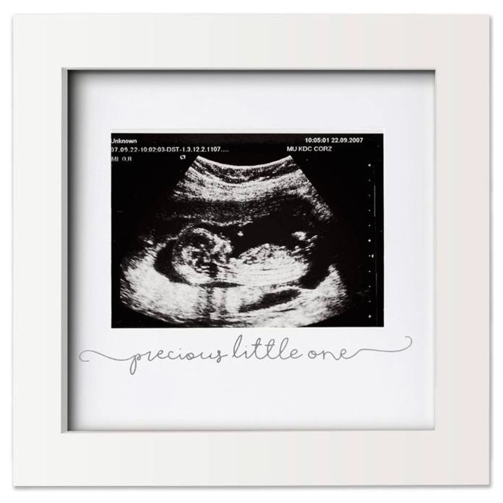 Keababies - Sonogram Frame - Alpine White