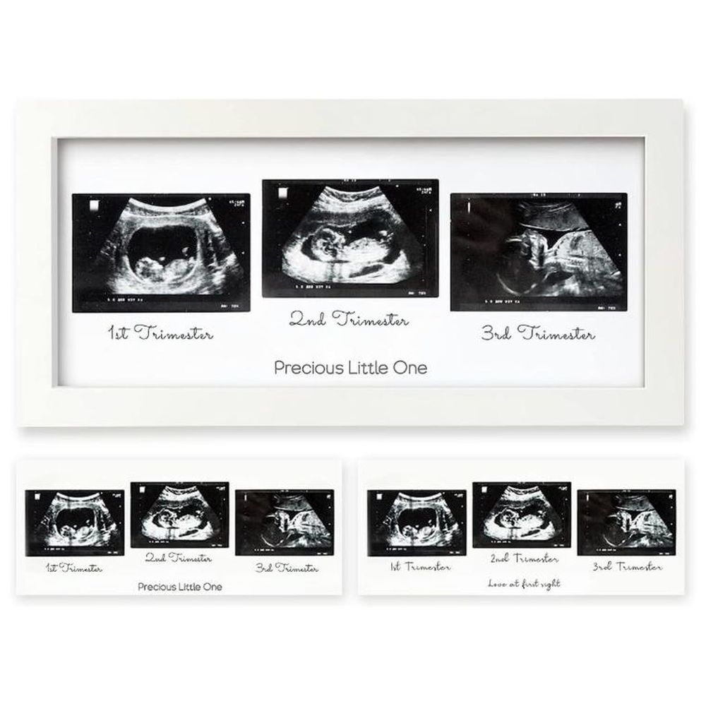 Keababies - Trio Sonogram Frame - Alpine White