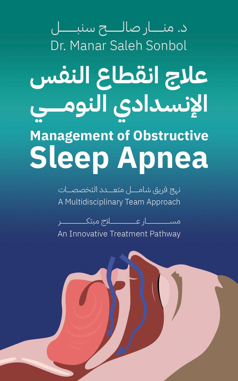 Management Of Obstructive Sleep Apnea