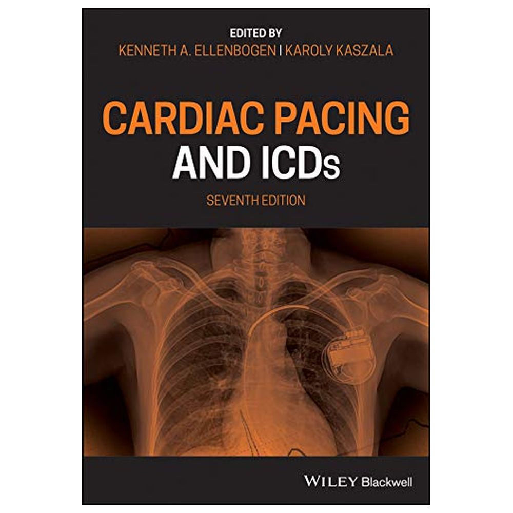 Cardiac Pacing And ICDs
