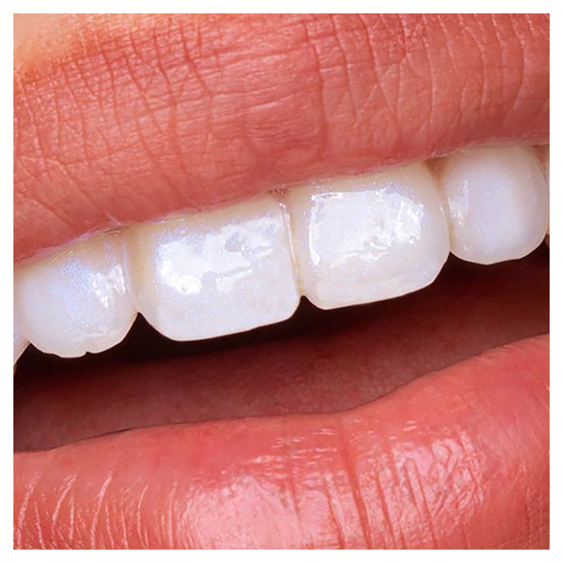 Hismile - Glostik Tooth Gloss - Purple